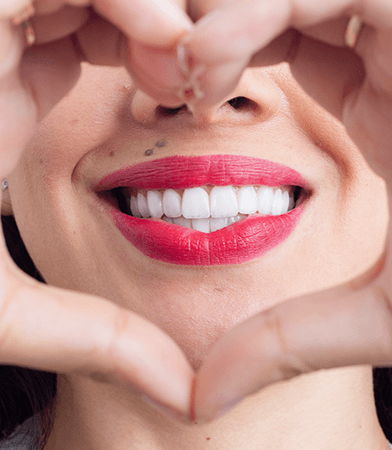 Diseño de Sonrisa