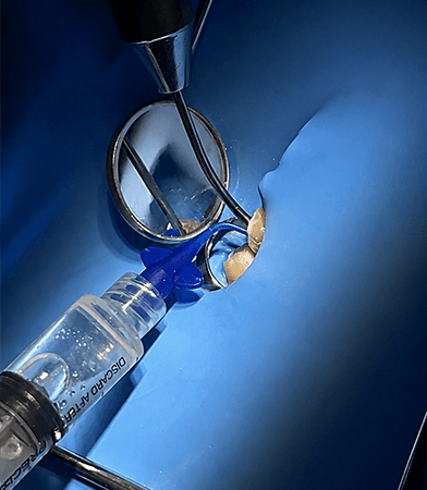 Endodoncia Clinica Santa Luciana